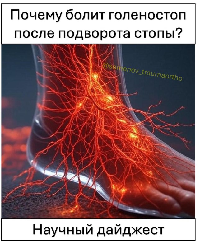 Что ИМЕННО болит после подворота стопы? — рентгенограмма, разбор клинического случая