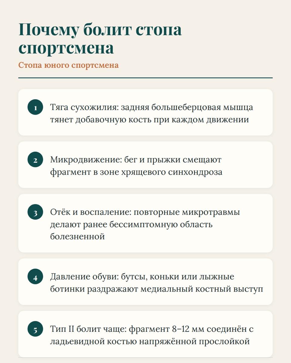 Добавочная ладьевидная кость: когда анатомический вариант мешает спорту — иллюстрация к материалу