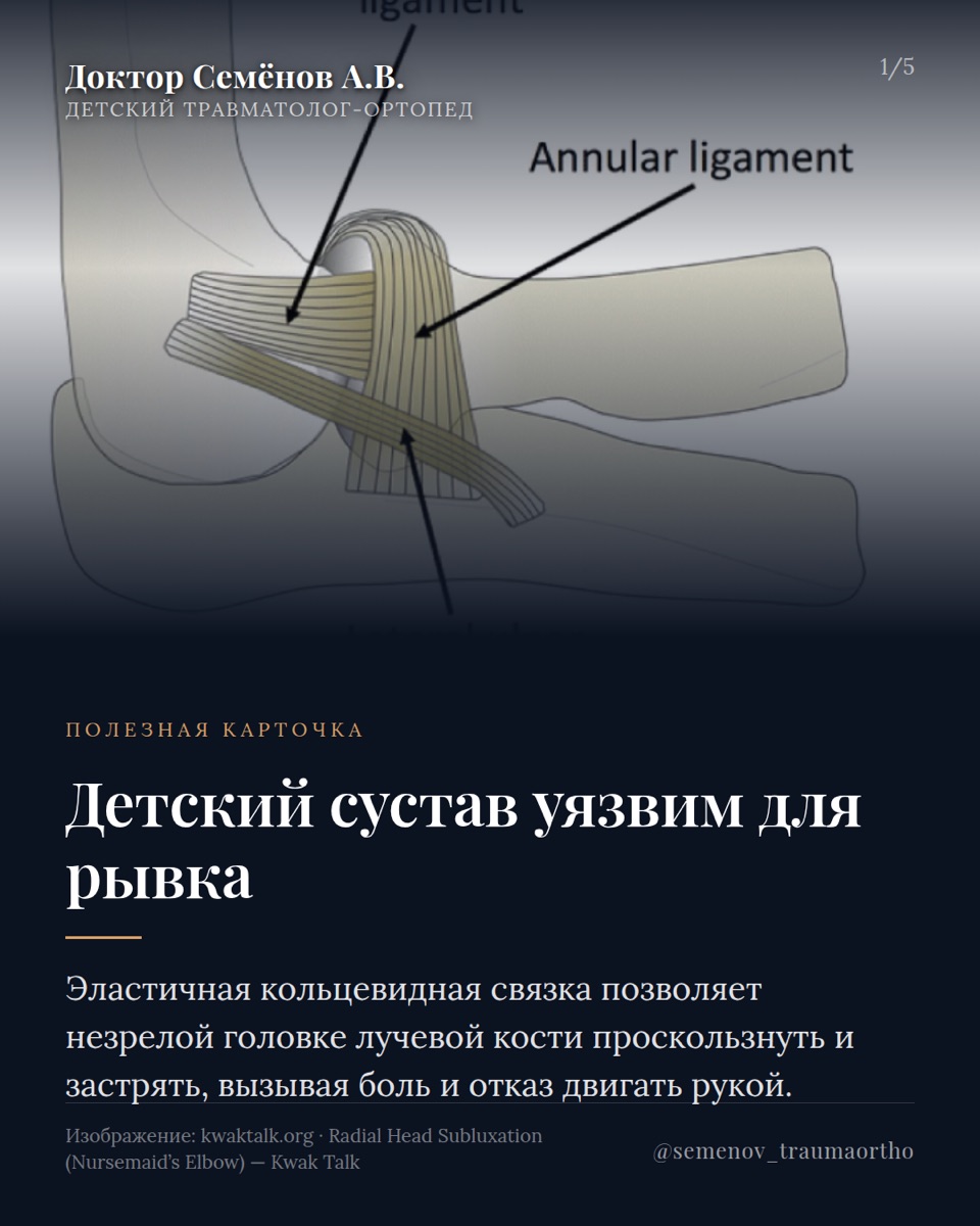 «Локоть няньки»: почему нельзя резко поднимать ребёнка за руку — иллюстрация к материалу