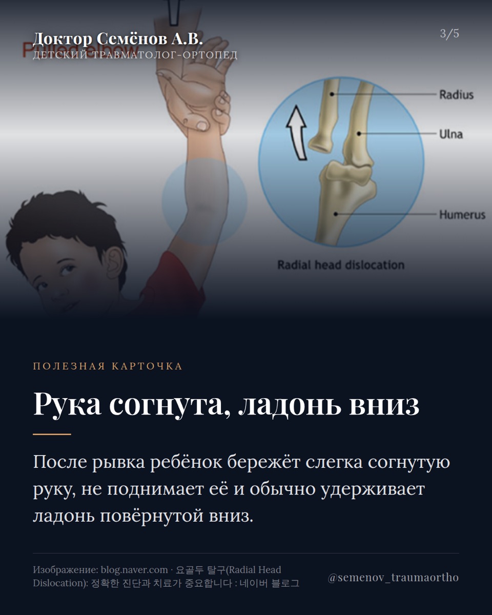 «Локоть няньки»: почему нельзя резко поднимать ребёнка за руку — иллюстрация к материалу