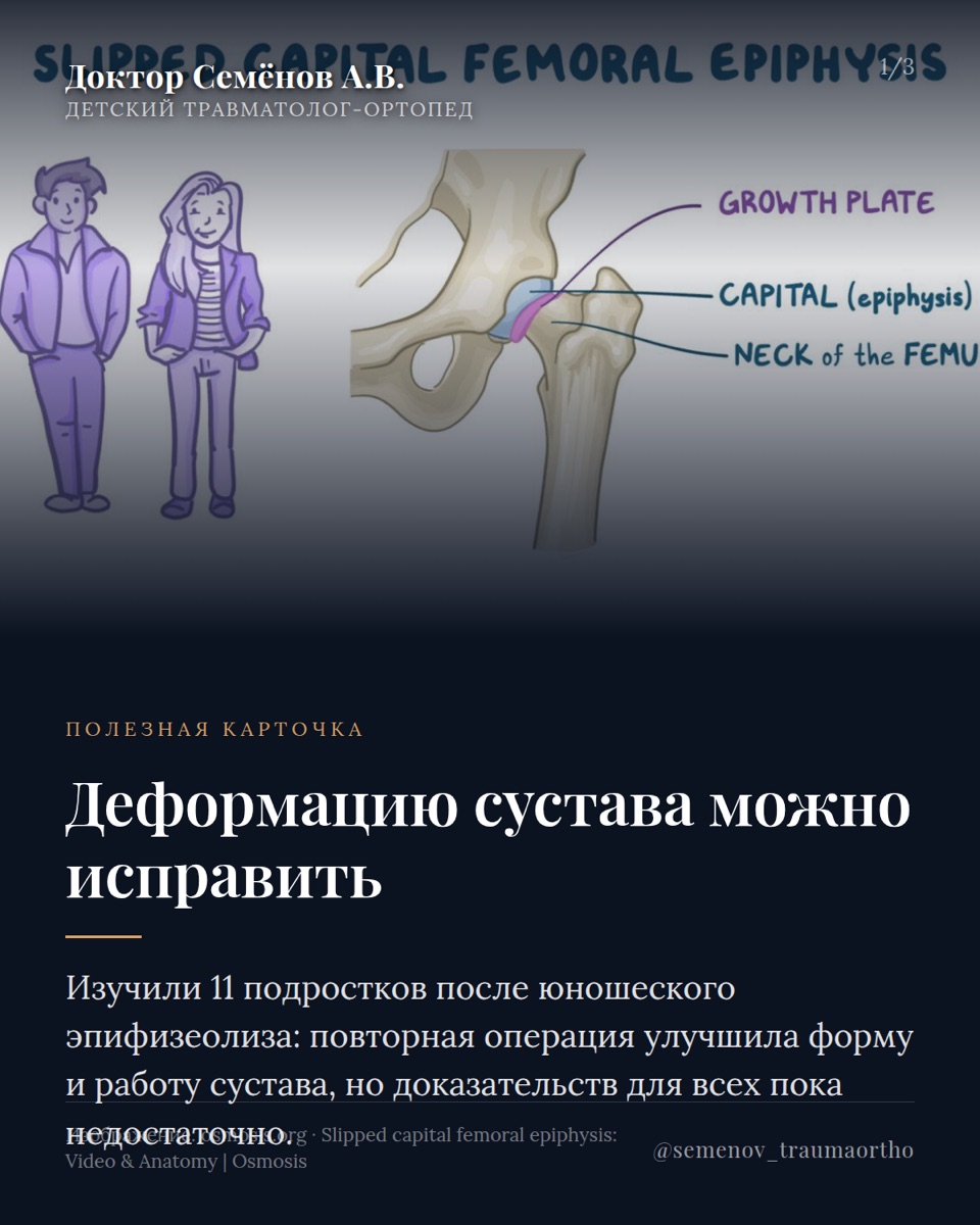 Научный бриф: новые исследования в детской ортопедии — иллюстрация к материалу