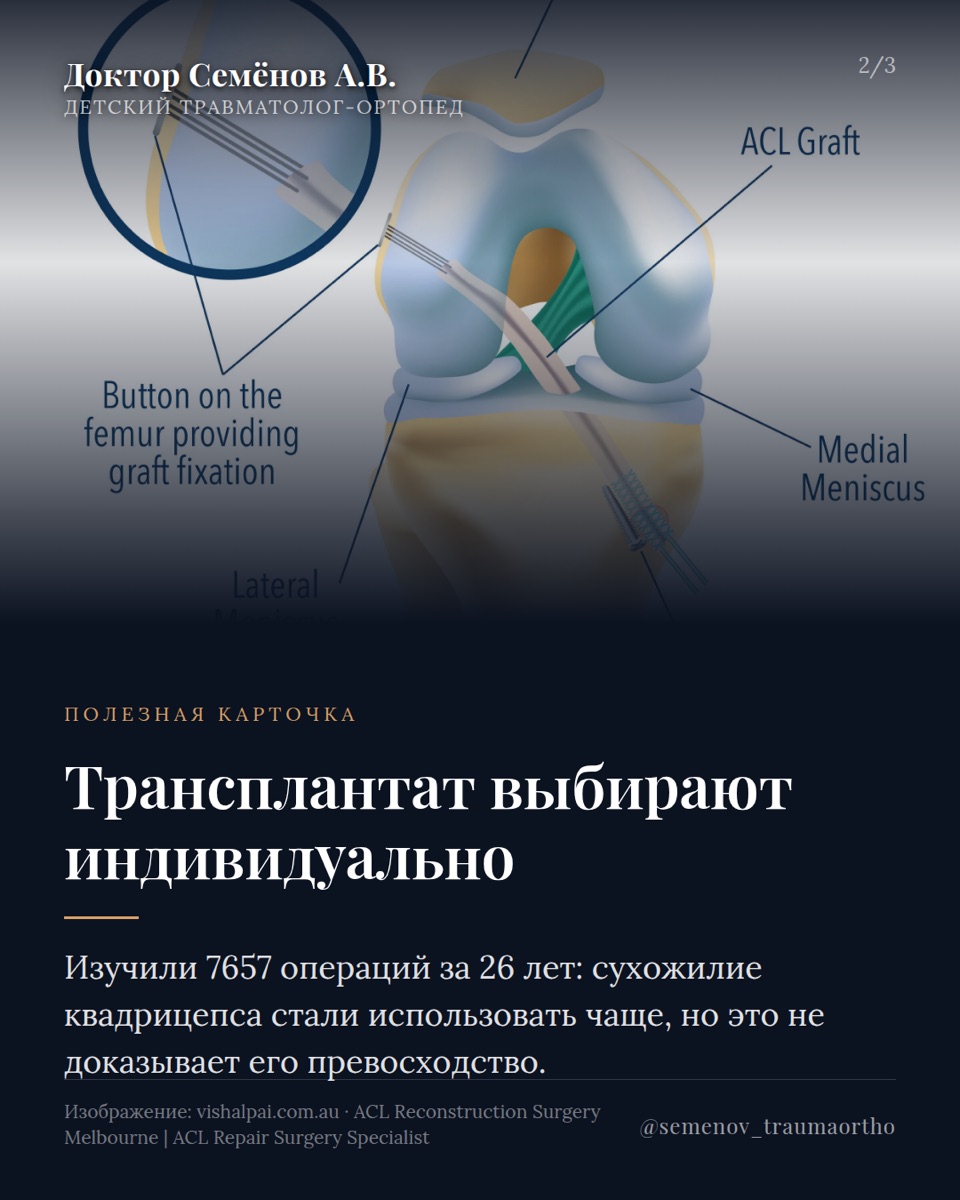 Научный бриф: новые исследования в детской ортопедии — иллюстрация к материалу