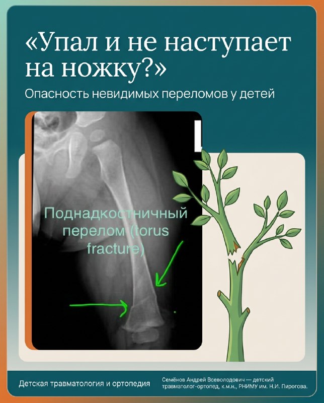Невидимый перелом у детей: опасность батутов — рентгенограмма, разбор клинического случая