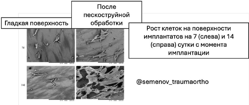 Пескоструйная обработка улучшает биоактивность титановых имплантатов — иллюстрация к материалу