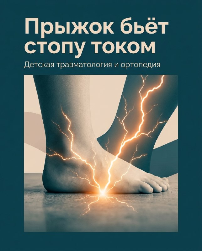 Плоскостопие и прыжки: почему стопу «разламывает» и что делать