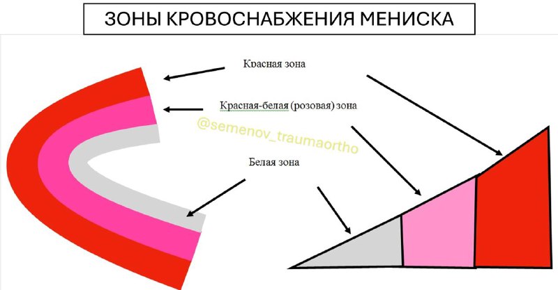 Реабилитация после шва мениска — рентгенограмма, разбор клинического случая