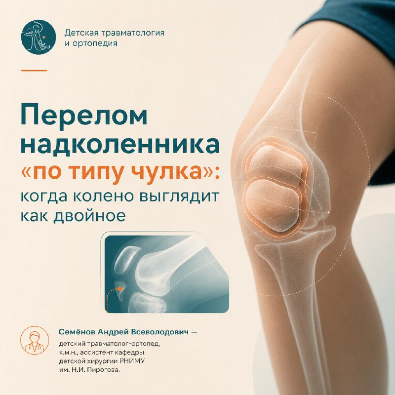 Скрытый перелом надколенника у детей: почему его пропускают