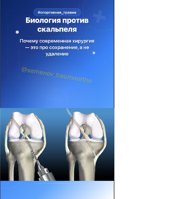 Современная хирургия ПКС: сохранение вместо удаления — рентгенограмма, разбор клинического случая
