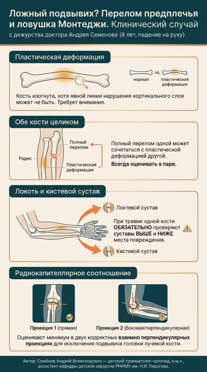 Рентгеновская ловушка: пластическая деформация без вывиха — изображение к разбору клинического случая